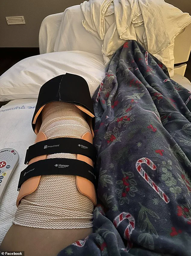 Healthcare Worker Survives Devastating Attack by Family Pit Bull, Faces Leg Amputation