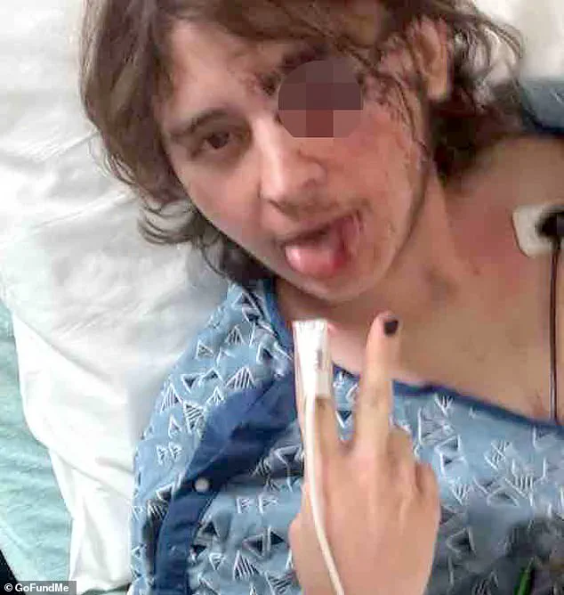 Alleged ICE Projectile Injury Leaves Protester Blind, Sparks Force Debate in Santa Ana