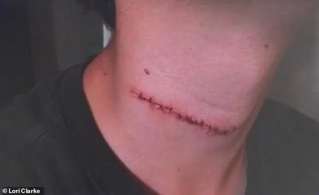 Brutal Attack on Daytona Beach: 13-Year-Old's Throat Slashed by Stranger