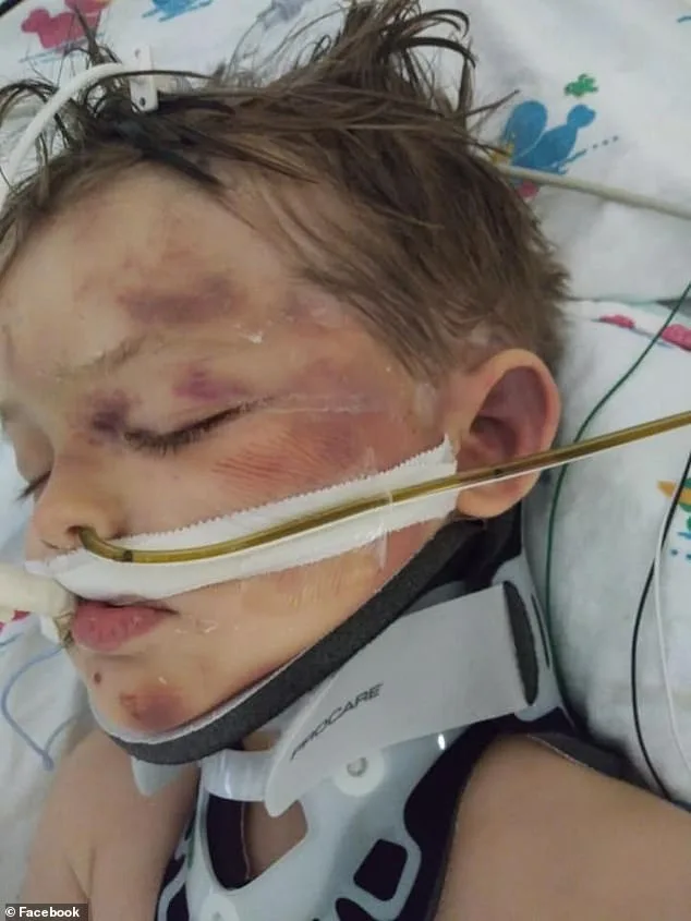 Oil Heir Ordered to Pay $1 Billion After Frenzied Attack Left Stepchild Permanently Disabled