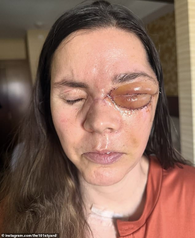 Kenai Mother Survives Bear Attack Dragging Her 100 Yards
