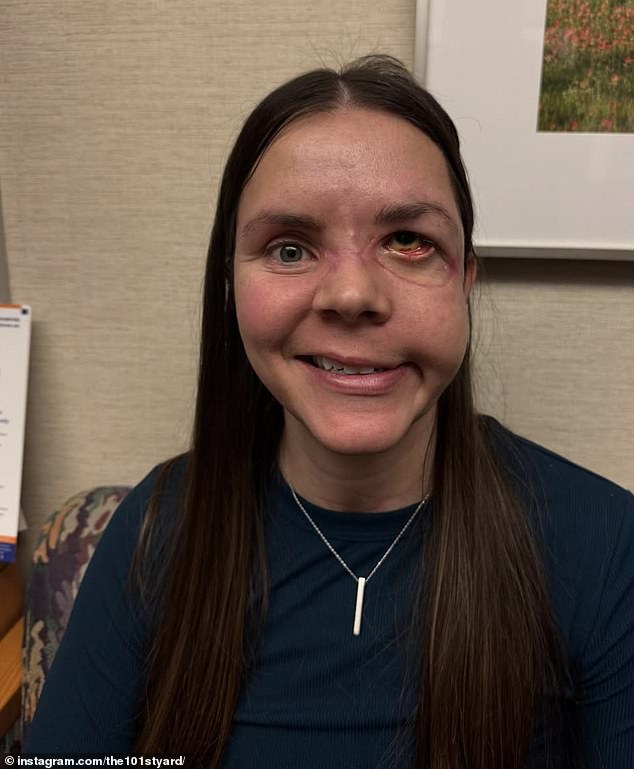 Kenai Mother Survives Bear Attack Dragging Her 100 Yards