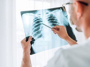 New urine test could detect lung cancer years early for NHS patients.